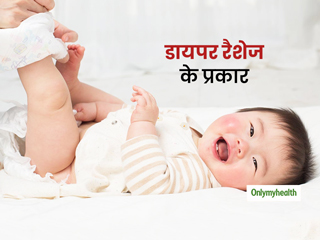 शिशु को परेशान कर सकता है डायपर के कारण होने वाले रैशेज, जानें डायपर रैशेज के प्रकार और इसके उपचार